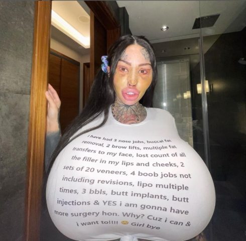 «Жертва пластики» с 38-м размером груди сделала 360 операций по изменению внешности (ФОТО) 