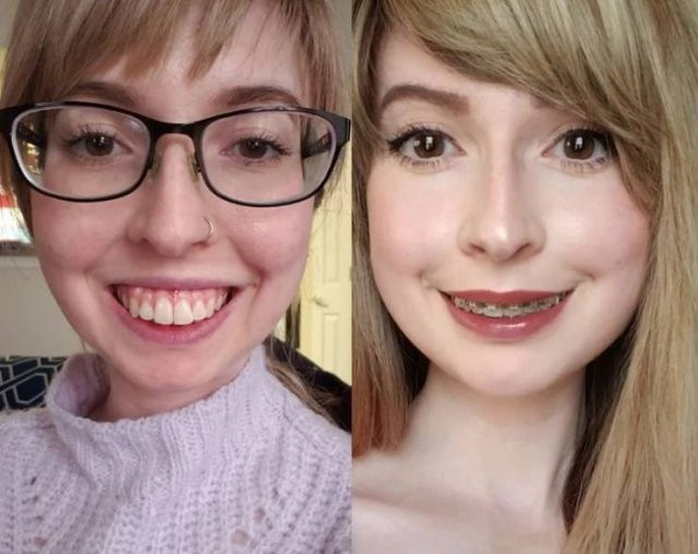 Фотографии до и после кардинального изменения внешности