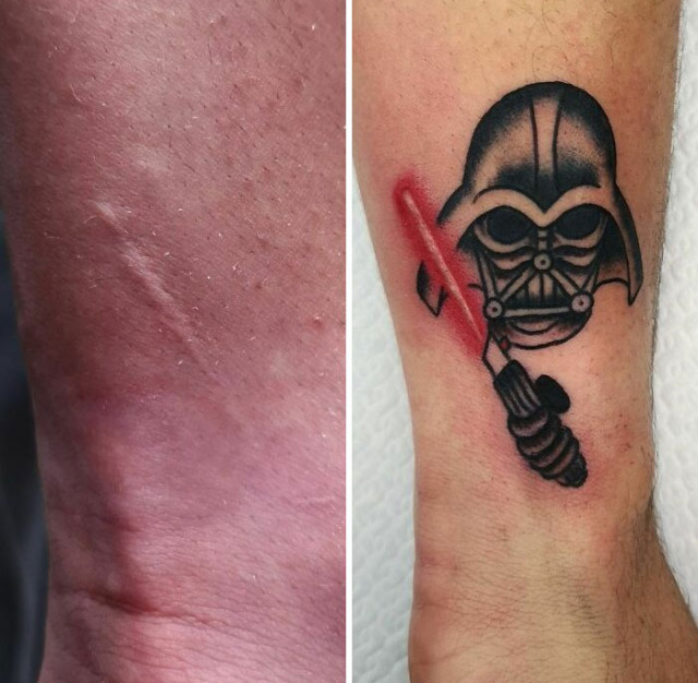 Кавер-ап татуировки, с помощью которых мастера превратили изъяны кожи в произведения искусства