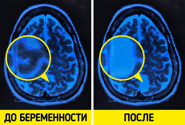 14 циничных уроков, которые нужно усвоить до 30 лет, чтобы не жить в иллюзиях до пенсии