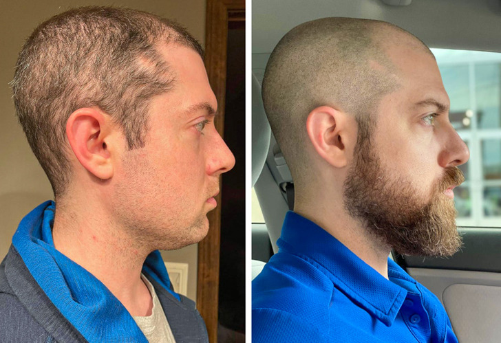 18 мужчин, которые отпустили бороду и жалеют, что не сделали этого раньше
