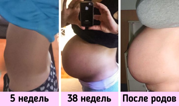 16 женщин, которые убедились в том, что беременность — это время не только умильных снимков, но и испытаний на прочность