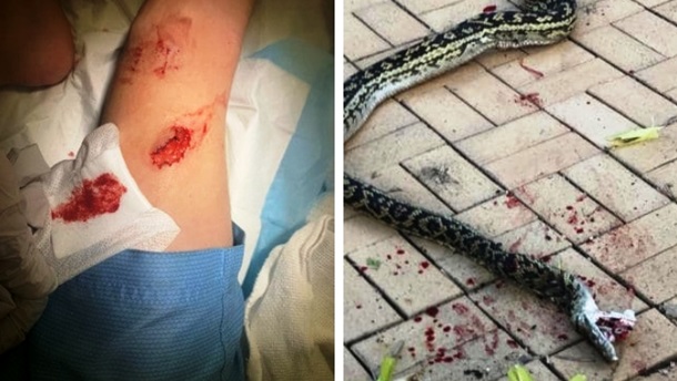 Австралиец дважды отбил своего сына у кровожадного питона. Фото