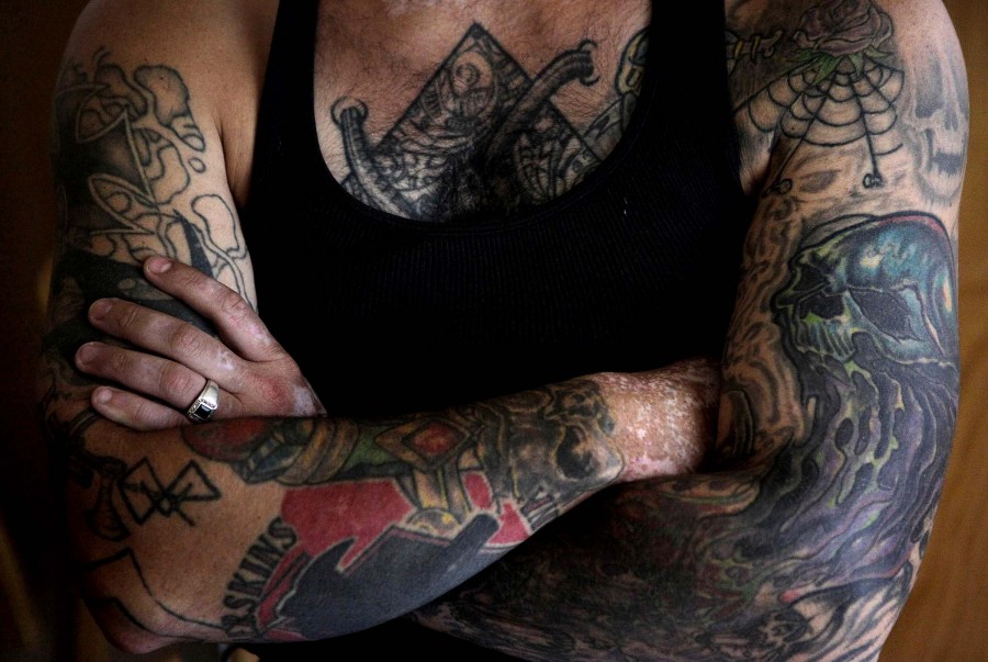 Так выглядит американец, удаливший все татуировки с лица. Фото