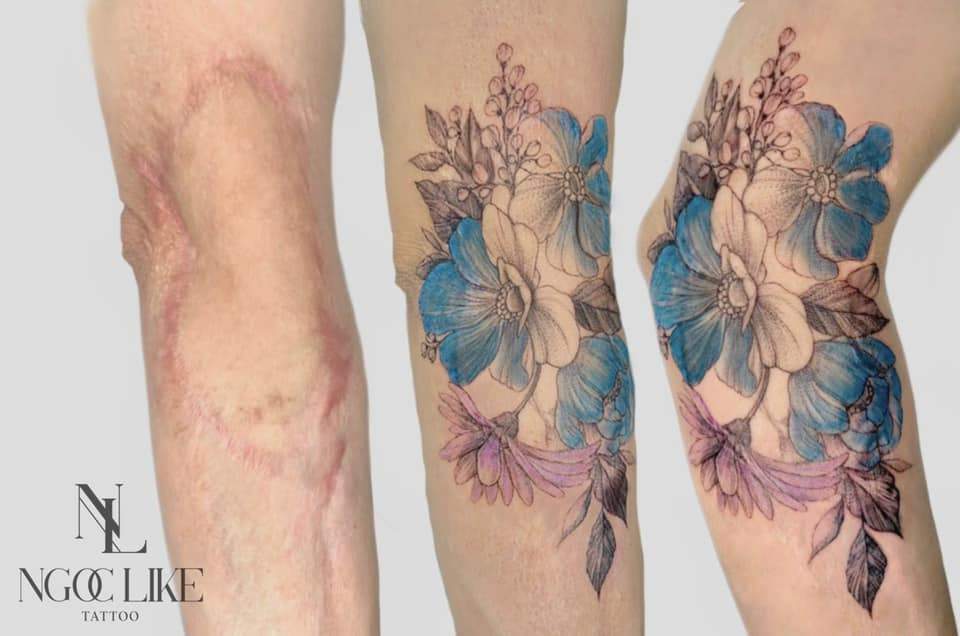 Художница украшает шрамы оригинальными татуировками. Фото