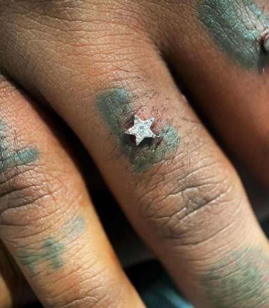 Рэпер Lil Uzi Vert с бриллиантом во лбу вживил алмазы в пальцы (ФОТО)