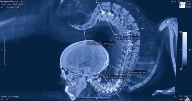 15 разів, коли люди робили рентгенівські знімки та отримували цікаві результати (фото)