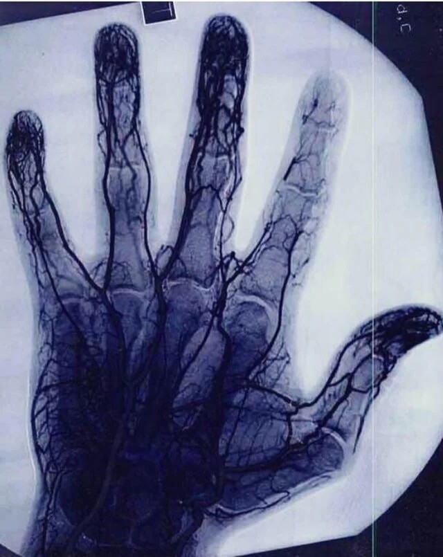 15 раз, когда люди делали рентгеновские снимки и получали интересные результаты   (фото)