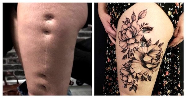 Люди показали, как с помощью татуировок изъяны кожи превратили в украшение (фото)