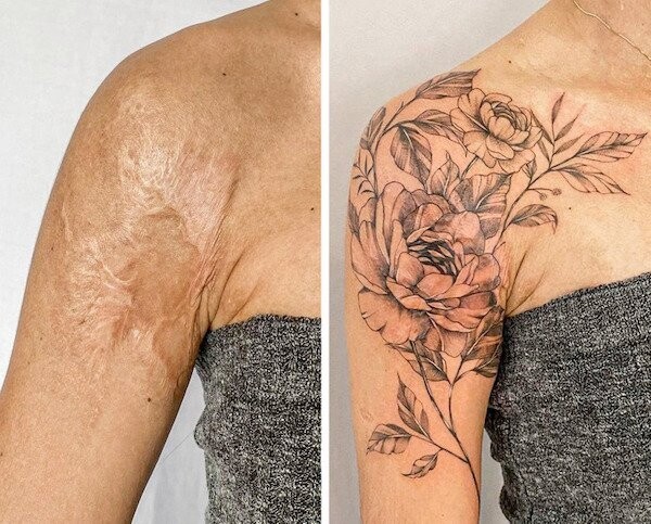 Люди показали, як за допомогою татуювань вади шкіри перетворили на прикрасу (фото)