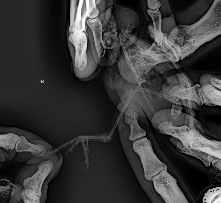 18 випадків, коли рентген та УЗД показали світ під таким кутом, під яким звичайному оку нічого не розглянути