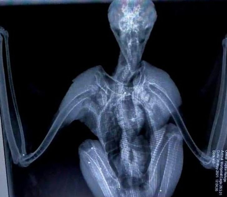 18 случаев, когда рентген и УЗИ показали мир под таким углом, под каким обычному глазу ничего не разглядеть
