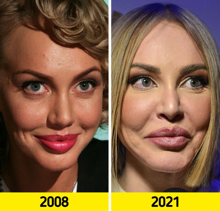 20 порівнянь крупним планом, які покажуть, як із роками змінилися обличчя наших знаменитостей