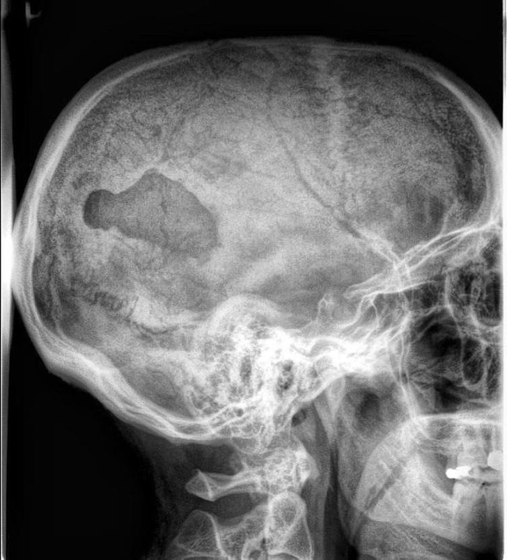 18 випадків, коли рентген та УЗД показали світ під таким кутом, під яким звичайному оку нічого не розглянути