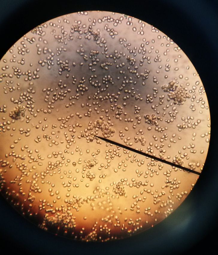 Сосиски под микроскопом и еще 16 фото с максимальным увеличением