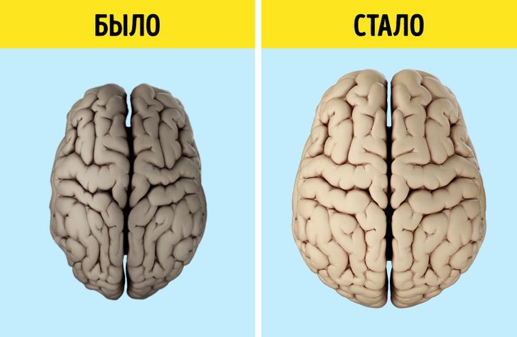 Група людей обернула старіння мозку всього за 6 місяців, і цей досвід можна повторити самостійно