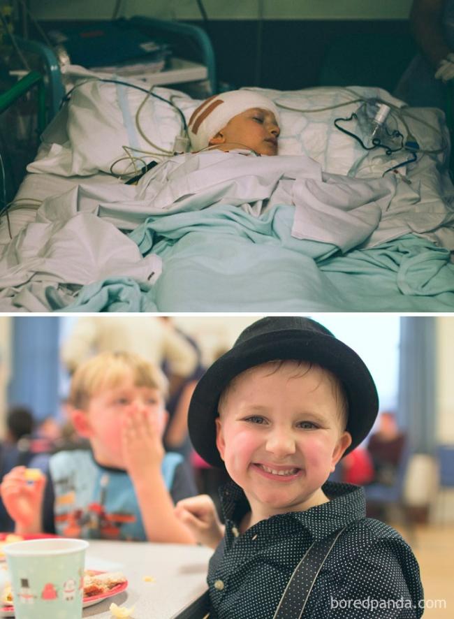 Они смогли победить рак: мощные снимки людей «до и после» (ФОТО)