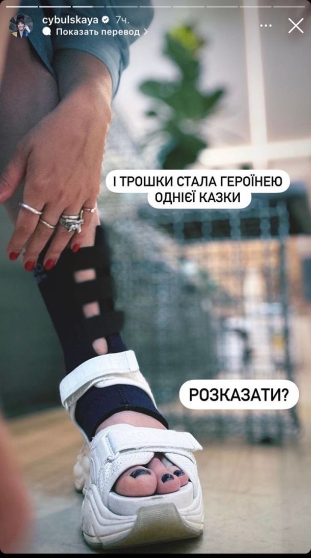 Оля Цибульська впала зі сходів та отримала серйозну травму (ФОТО)