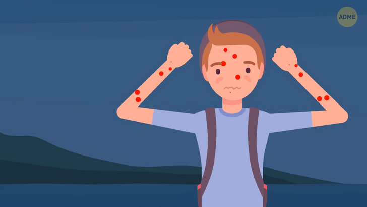 Що станеться з вашим тілом, якщо вас вкусить 1000 комарів? (фото, відео)