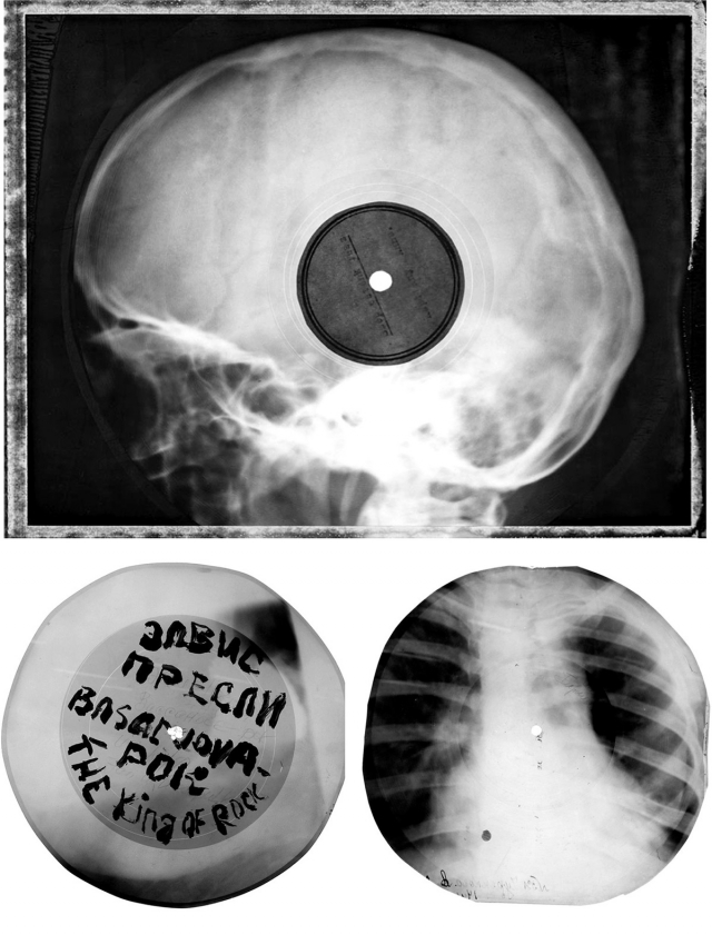 Музика на кістках: як у СРСР заборонену західну музику підпільно записували на рентгенівських знімках