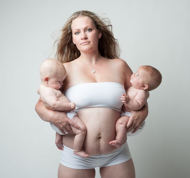 Фотографї, які показують, що тіло жінки після пологів виглядає зовсім не так, як у журналах про вагітність