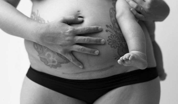 Фотографї, які показують, що тіло жінки після пологів виглядає зовсім не так, як у журналах про вагітність