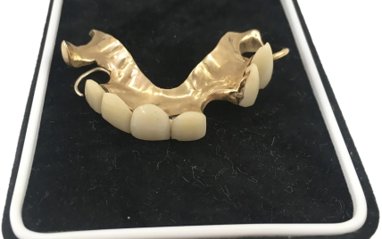 Вставні зуби Вінстона Черчилля продали на аукціоні: за скільки їх купили
