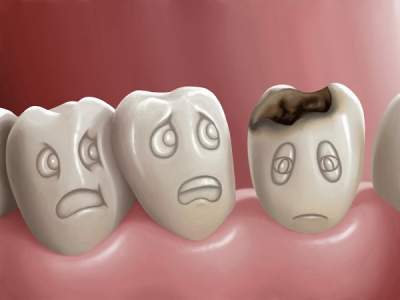 Эти ошибки гарантируют вам проблемы с зубами