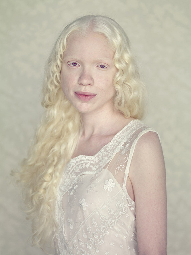 Альбиносы в фотопроекте Густаво Ласерде
