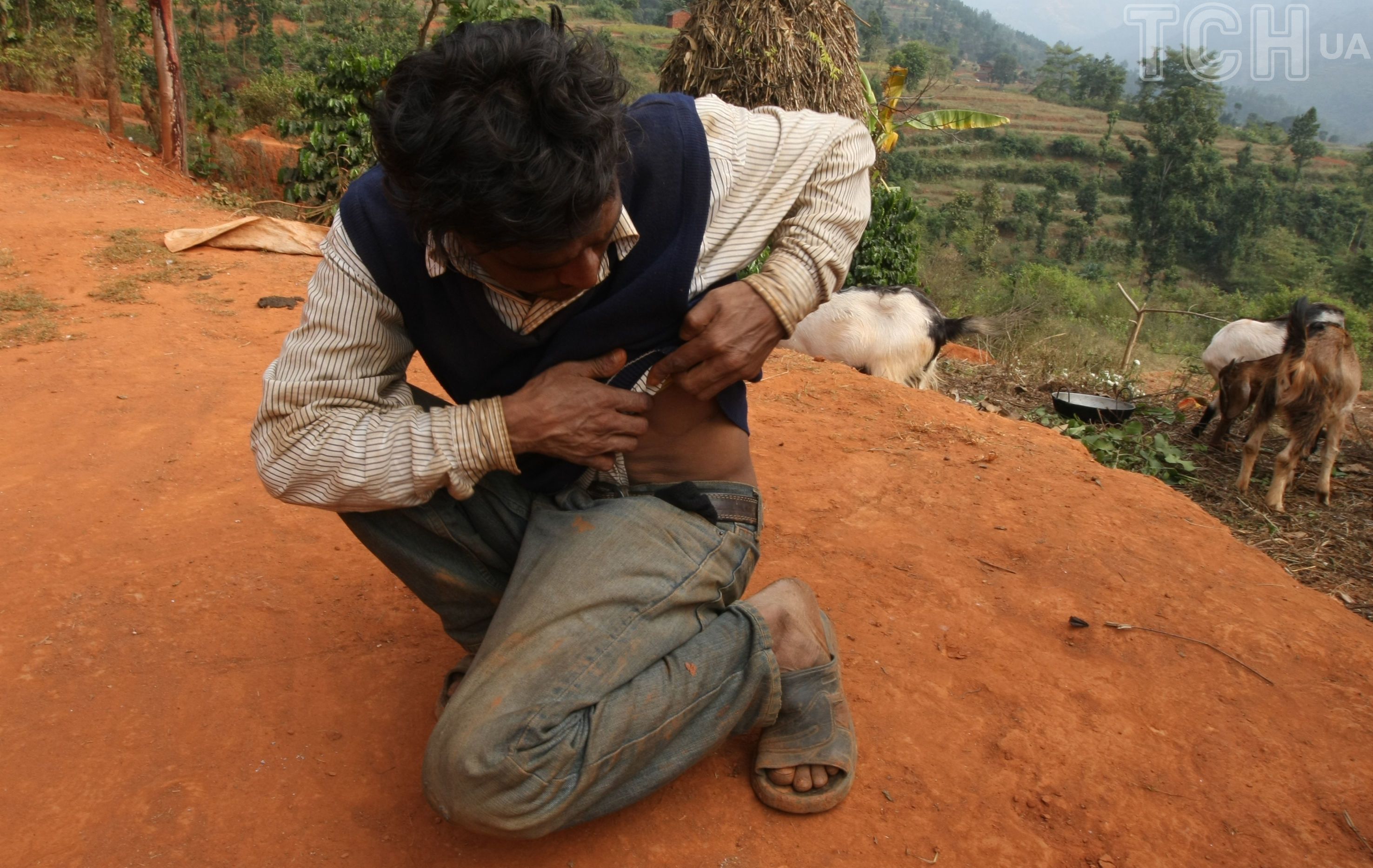 Мадав Параджулі демонструє свій шрам / © Getty Images