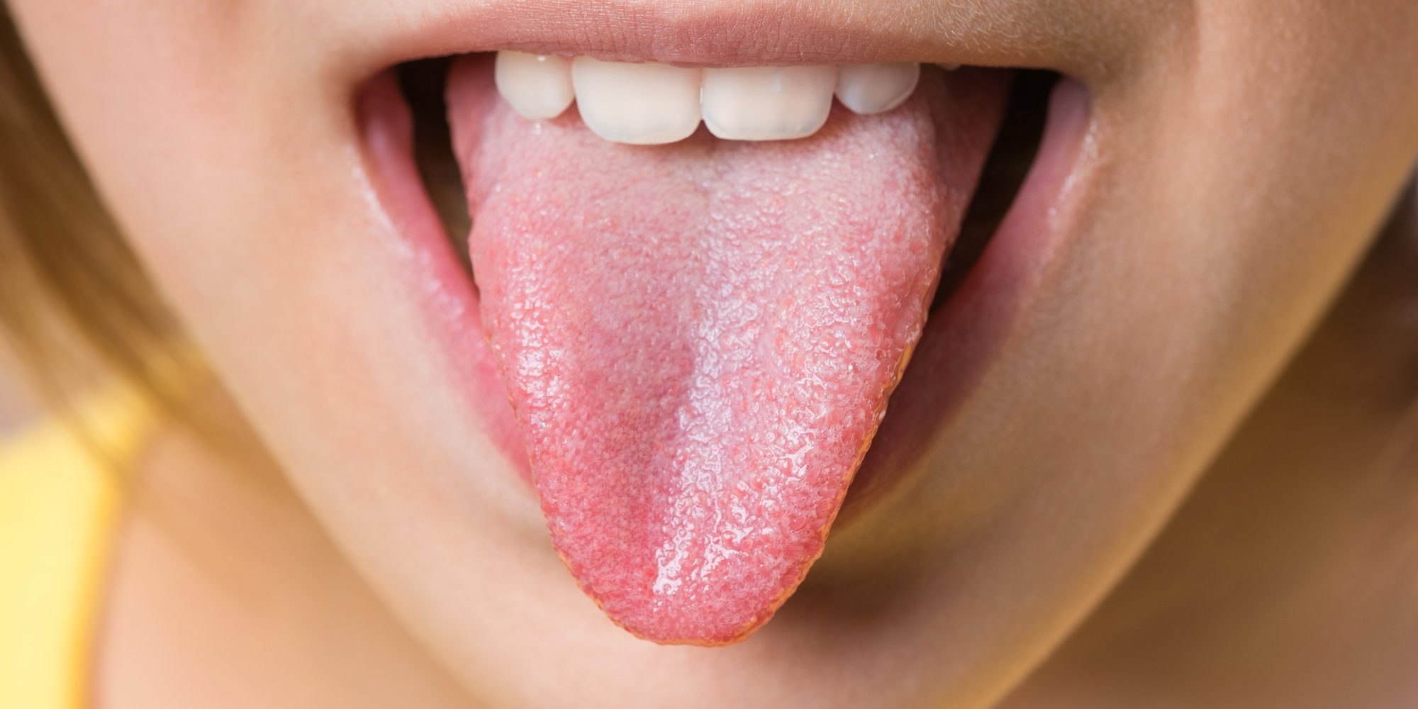 Про які небезпечні хвороби може розповісти колір язика