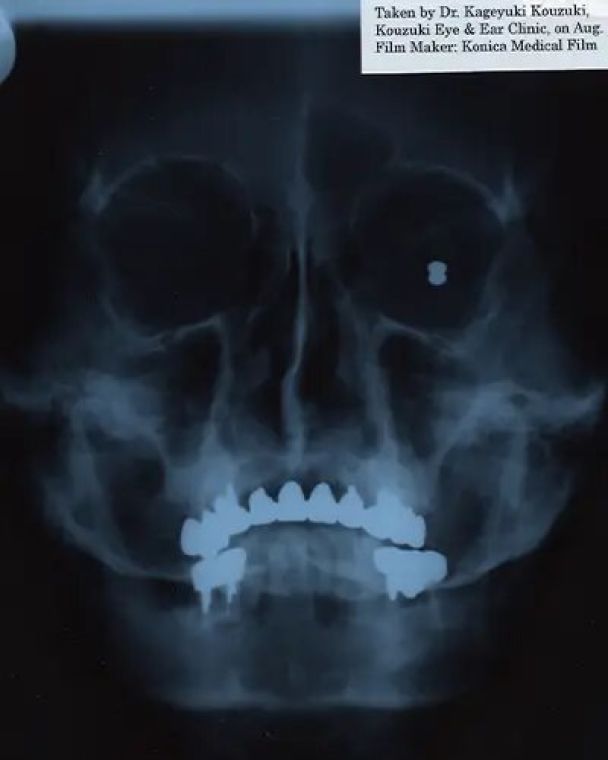 Рентген черепа Сатору, зроблений 2001 року / © guinnessworldrecords.com