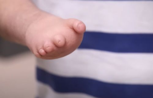 Школярі виготовили для свого однокласника протез руки (ВІДЕО)