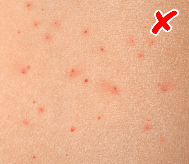 8 серьезных заболеваний, о которых сигнализирует наша кожа