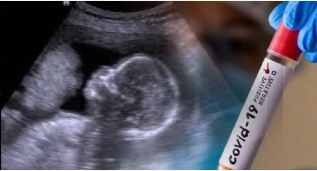 COVID під час вагітності може впливати на мозок дитини — вчені попереджають про небезпечний зв’язок