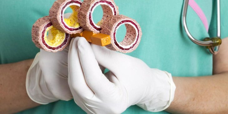 Медики розповіли, як вивести з організму вільні радикали