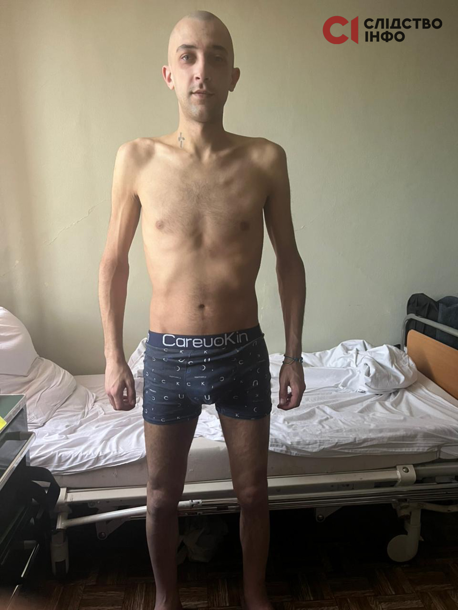 «Шкіру живцем виривали, у мене на всю спину шрам», — звільнений з полону прикордонник про тортури у російських тюрмах