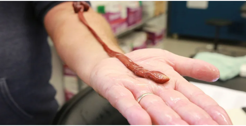 Гігантський стрічковий черв'як виявився найстарішим у світі: скільки років рекордсмену (фото)