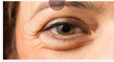 За мішкам під очима можна дізнатися, який орган хворий