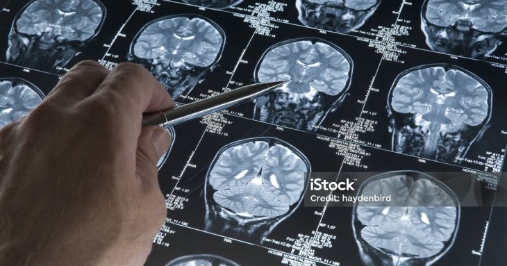 Як&nbsp;омолодити мозок на&nbsp;8&nbsp;років: вчені назвали чотири прості звички, що&nbsp;подовжують життя