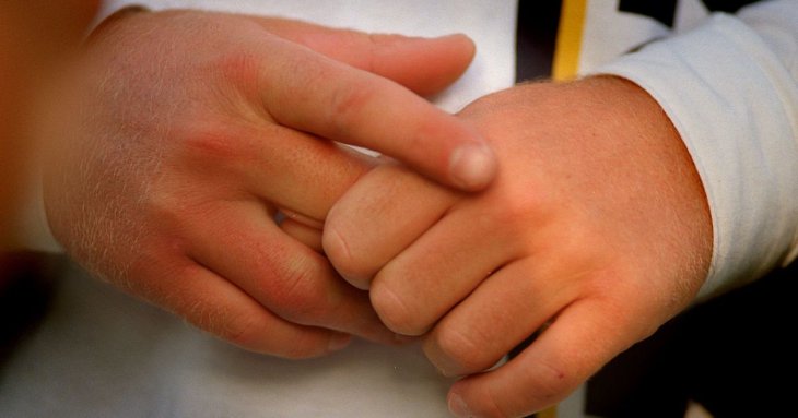 Чи&nbsp;справді шкідливо хрустіти пальцями і&nbsp;буде артрит: ортопед відповів