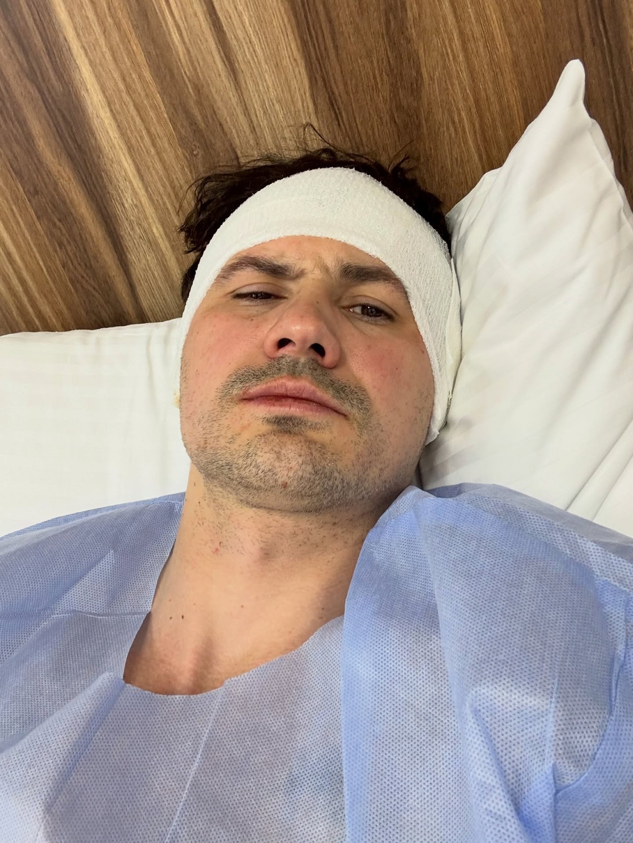 Євген Кот заінтригував операцією на вухах та відповів на критику у мережі