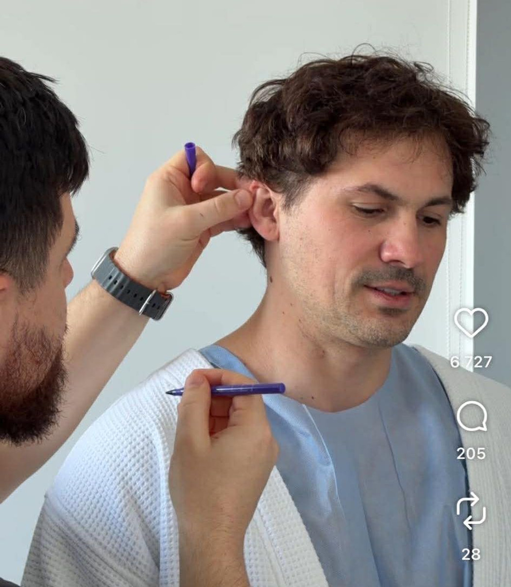 Євген Кот заінтригував операцією на вухах та відповів на критику у мережі