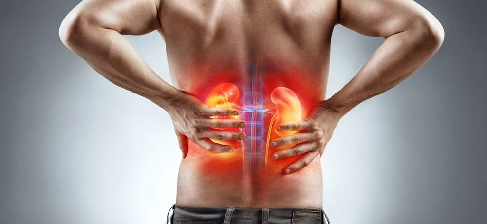 Раптовий біль, що не дає спокою – як розпізнати ниркову кольку і діяти правильно