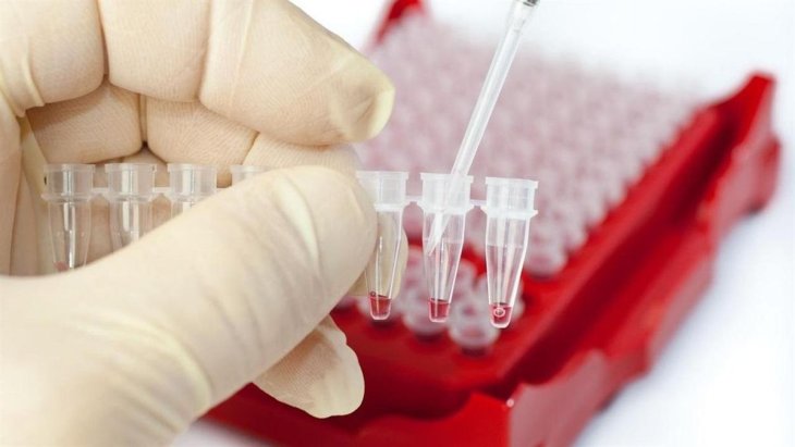 Виявляє хворобу до перших симптомів: у Британії розробили новий метод діагностики раку