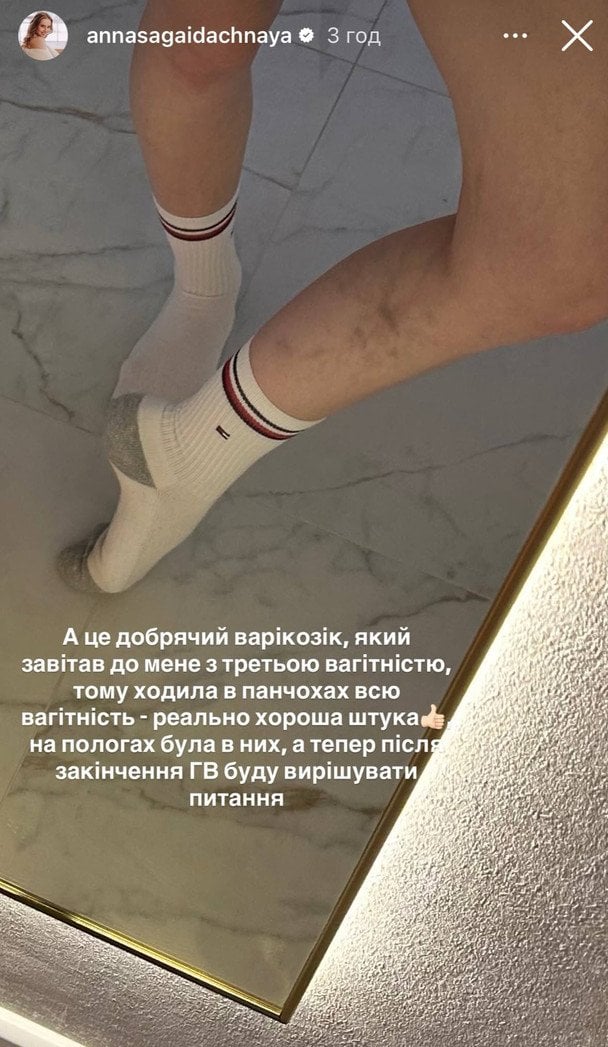 Анна Сагайдачна / &copy; instagram.com/annasagaidachnaya