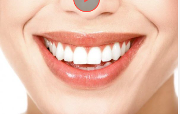 Продукти, що нищать зуби: поради стоматолога щодо захисту та відновлення емалі