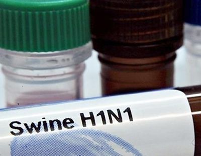 ГПУ завела уголовное дело по закупке вакцины от «свиного» гриппа 