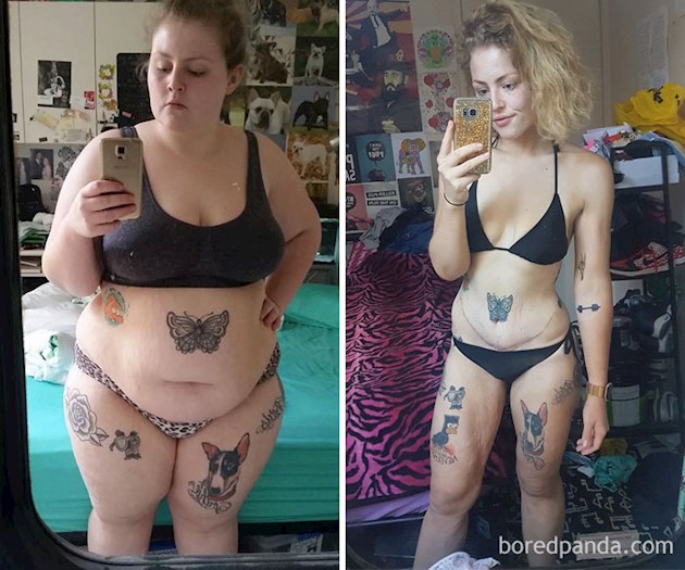 Потрясающие фото людей \"до\" и \"после\" активного похудения