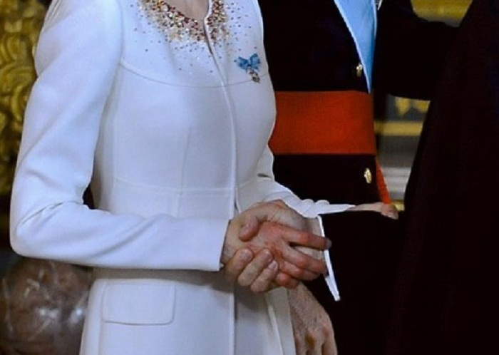 Вот так выглядела правая рука новой Королевы Испании Летиции после трёх тысяч рукопожатий во время приёма гостей во дворце после провозглашения ее супруга королем Испании.